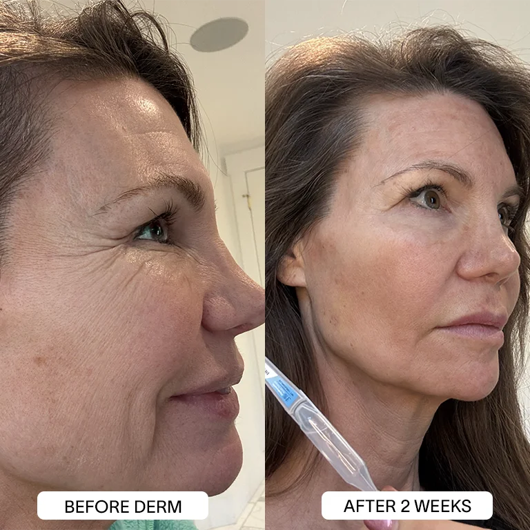 Derm™ 3% Hyaluronic Acid - Cyber Monday Sale - Image 14