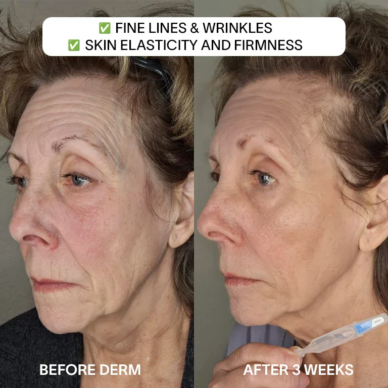 Radiant & Youthful Skin Bundle - Image 4