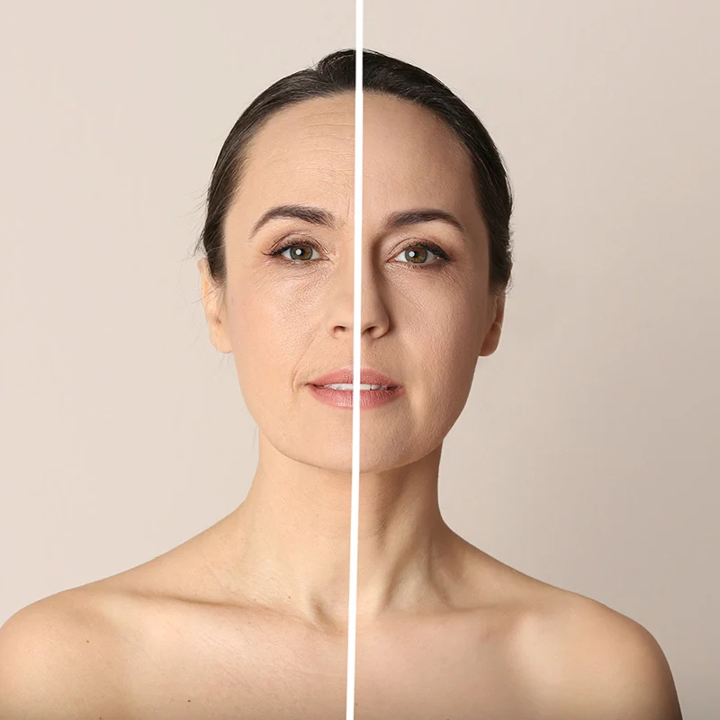 Derm™ Micro-Infusion System - Image 4